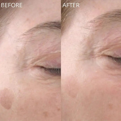 GlowBiotics Probiotic Advanced Vitamin C Brightening Anti-Aging Serum For All Skin Types 30ml GlowBiotics