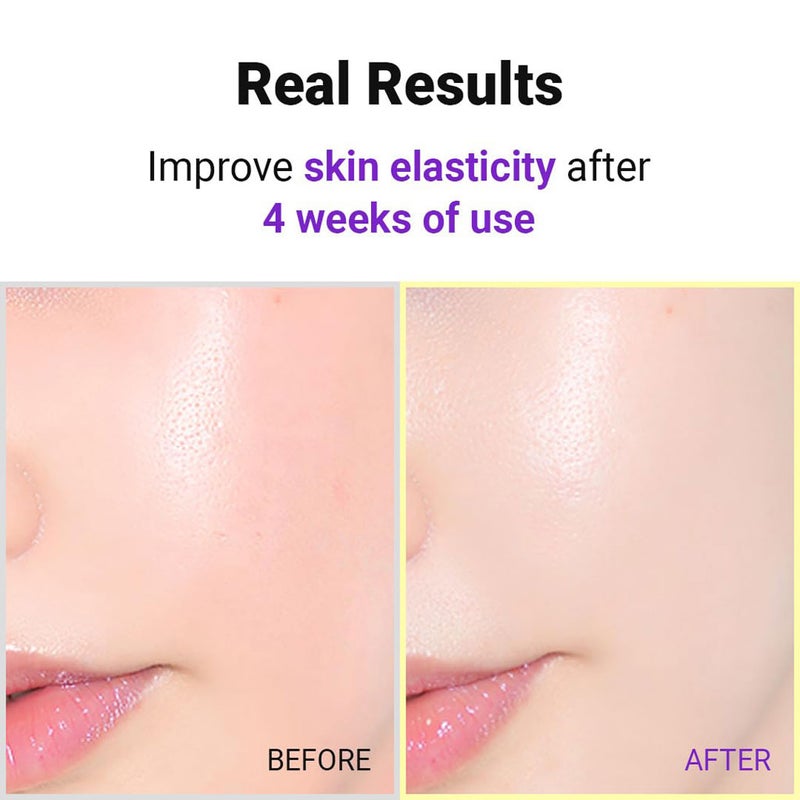 Isntree Hyper Retinol Ex 1.0 Face Serum 20ml Isntree