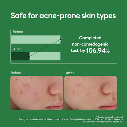 Mediheal Teatree Calming Hydra, Refreshing, Lightweight Hydrating Serum - 40ml Mediheal