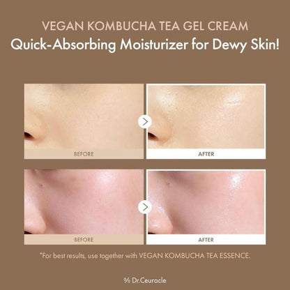 Dr. Ceuracle Vegan Kombucha Tea Gel Cream Probiotic Hydrating Detox Moisturizer 75g Dr. Ceuracle