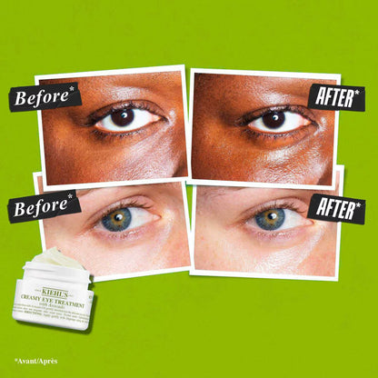 KIEHL'S SINCE 1851 Avocado Eye Cream - 14ml KIEHL'S