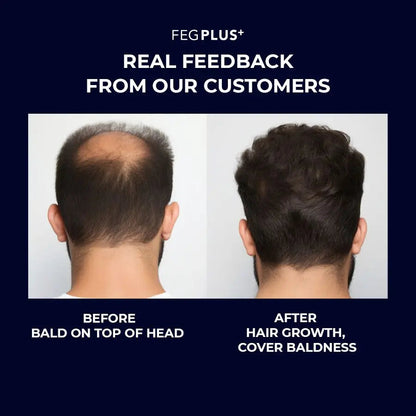 FEG Plus Hair Growth Serum with Hair Roller ( Original) FEGPLUS