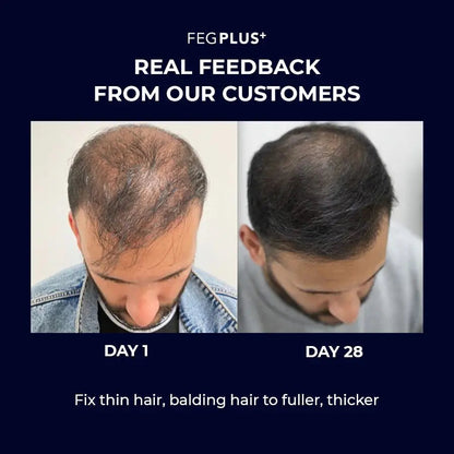 FEG Plus Hair Growth Serum with Hair Roller ( Original) FEGPLUS